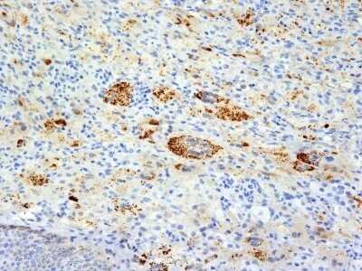 Immunohistochemistry-Paraffin: TNF-alpha Antibody (TNFA/1172) - IHC-Prediluted [NBP2-48470]