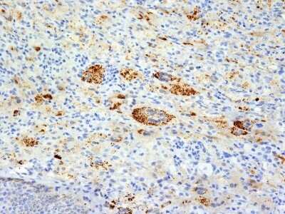 Immunohistochemistry-Paraffin: TNF-alpha Antibody (TNFA/1172) [NBP2-45331]