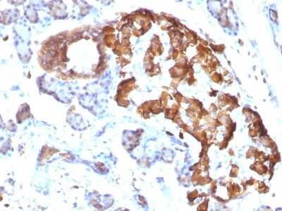 Immunohistochemistry-Paraffin: TNF-alpha Antibody (TNFA/1172) [NBP2-45331]