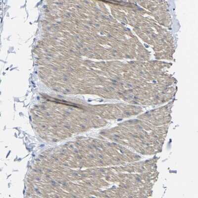 Immunohistochemistry-Paraffin: TNFAIP1 Antibody [NBP1-88930]
