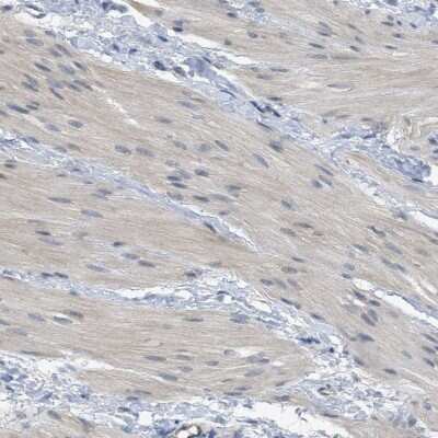 Immunohistochemistry-Paraffin: TNFAIP1 Antibody [NBP1-88931]