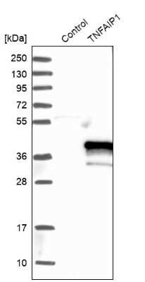 Western Blot: TNFAIP1 Antibody [NBP1-88931]