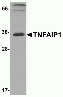 Western Blot: TNFAIP1 AntibodyBSA Free [NBP2-82039]