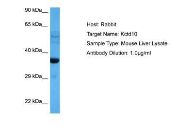 Western Blot: TNFAIP1 Antibody [NBP2-85959]