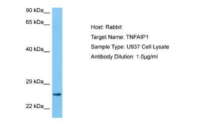 Western Blot: TNFAIP1 Antibody [NBP2-85962]