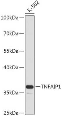 Western Blot: TNFAIP1 AntibodyAzide and BSA Free [NBP2-94181]