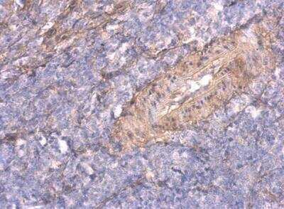 Immunohistochemistry-Paraffin: TNFAIP2 Antibody [NBP1-33480]