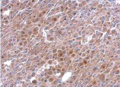 Immunohistochemistry-Paraffin: TNFAIP2 Antibody [NBP1-33480]