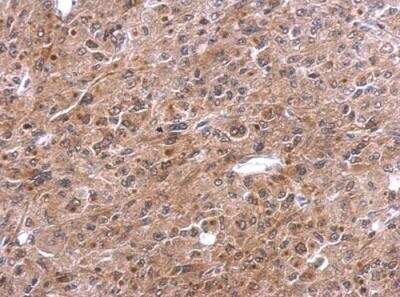 Immunohistochemistry-Paraffin: TNFAIP2 Antibody [NBP1-33480]