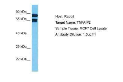 Western Blot: TNFAIP2 Antibody [NBP2-88445]