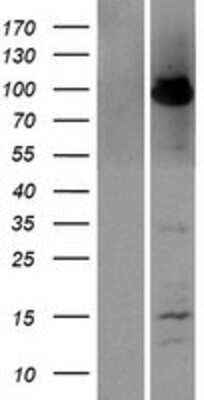 Western Blot: A20/TNFAIP3 Overexpression Lysate [NBP2-07646]