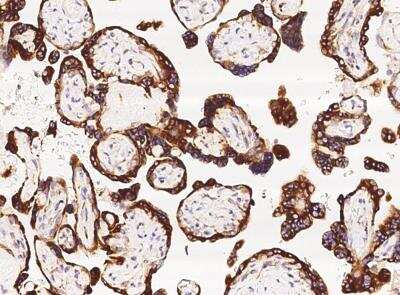 Immunohistochemistry-Paraffin: TNFAIP8 Antibody (01) [NBP3-06584]