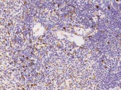 Immunohistochemistry-Paraffin: TNFAIP8 Antibody (01) [NBP3-06584]