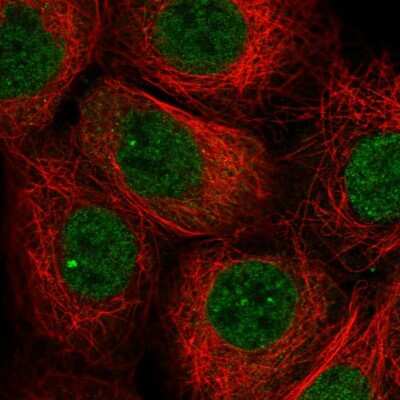 Immunocytochemistry/ Immunofluorescence: TNFAIP8 Antibody [NBP2-58181]