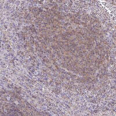 Immunohistochemistry-Paraffin: TNFAIP8 Antibody [NBP2-33814]