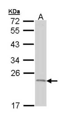 Western Blot: TNFAIP8 Antibody [NBP1-33406]