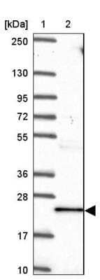 Western Blot: TNFAIP8 Antibody [NBP2-33814]