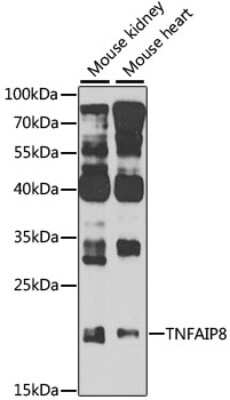 Western Blot: TNFAIP8 AntibodyBSA Free [NBP2-93767]