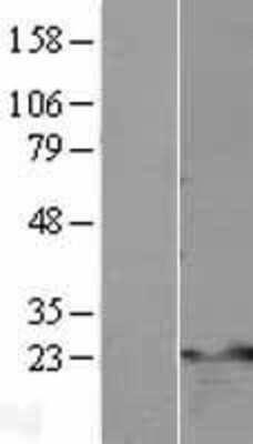 Western Blot: TNFAIP8 Overexpression Lysate [NBL1-17138]