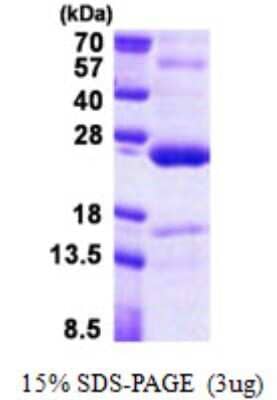 SDS-PAGE: Recombinant Human TNFAIP8 His Protein [NBP2-22908]