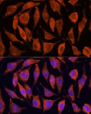 Immunocytochemistry/ Immunofluorescence: TNFAIP8L2 Antibody - Azide and BSA Free [NBP2-93009]