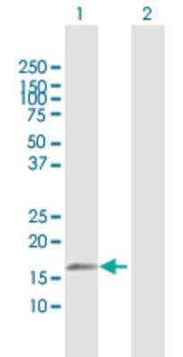 Western Blot: TNFAIP8L2 Antibody [H00079626-D01P]