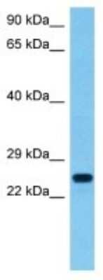 Western Blot: TNFAIP8L3 Antibody [NBP3-10186]