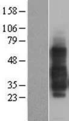 Western Blot: HVEM/TNFRSF14 Overexpression Lysate [NBL1-17150]