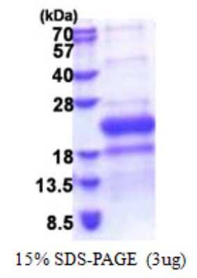 SDS-PAGE: Recombinant Human HVEM/TNFRSF14 His Protein [NBP2-22904]