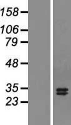 Western Blot: APRIL/TNFSF13 Overexpression Lysate [NBL1-17165]