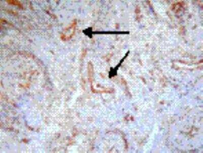 Immunohistochemistry-Paraffin: BAFF/BLyS/TNFSF13B Antibody (Buffy-2) [NBP1-97622]