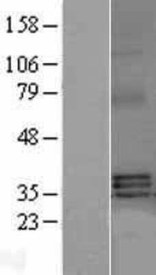 Western Blot: BAFF/BLyS/TNFSF13B Overexpression Lysate [NBL1-17166]