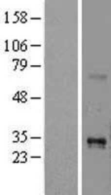 Western Blot: TL1A/TNFSF15 Overexpression Lysate [NBL1-17167]