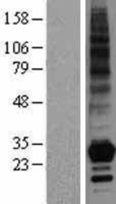 Western Blot: OX40 Ligand/TNFSF4 Overexpression Lysate [NBL1-17169]