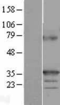 Western Blot: 4-1BB Ligand/TNFSF9 Overexpression Lysate [NBL1-17171]