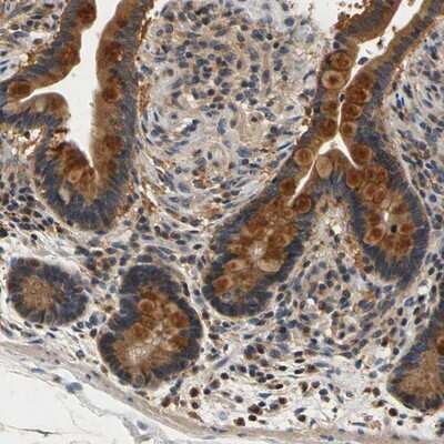 Immunohistochemistry-Paraffin: TNIK Antibody [NBP1-82994]