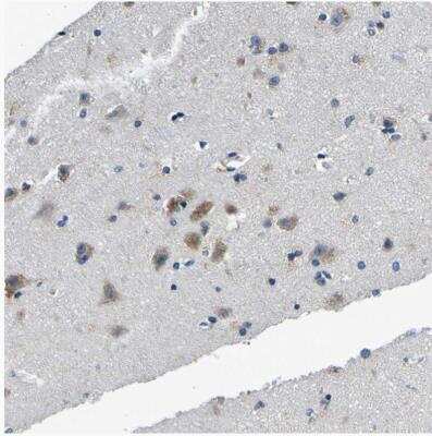 Immunohistochemistry-Paraffin: TNIK Antibody [NBP1-82994]