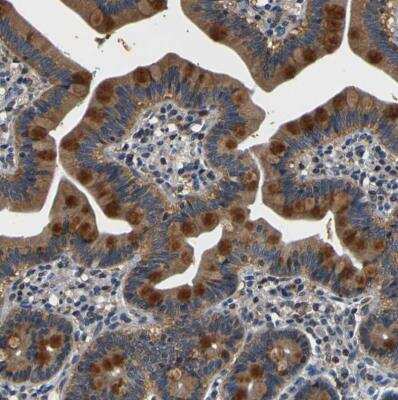Immunohistochemistry-Paraffin: TNIK Antibody [NBP1-82994]