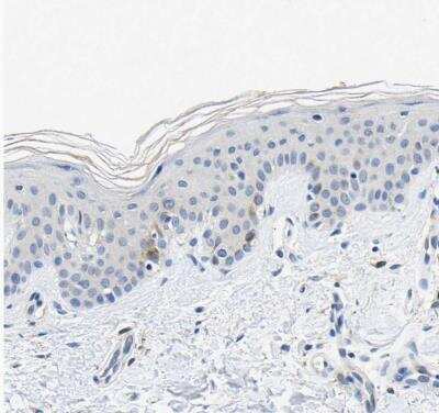 Immunohistochemistry-Paraffin: TNIK Antibody [NBP1-82994]
