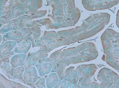 Immunohistochemistry-Paraffin: TNIK Antibody [NBP3-13022]