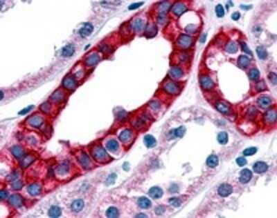 Immunohistochemistry-Paraffin: TNIK Antibody - BSA Free [NLS7401]