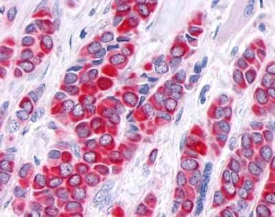 Immunohistochemistry-Paraffin: TNIK Antibody - BSA Free [NLS7401]
