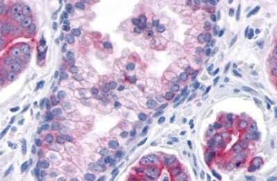 Immunohistochemistry-Paraffin: TNIK Antibody - BSA Free [NLS7401]