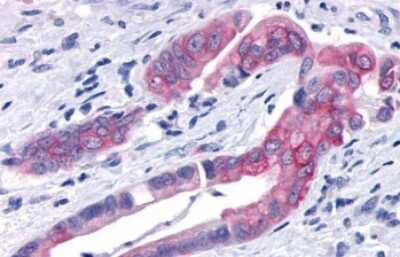 Immunohistochemistry-Paraffin: TNIK Antibody - BSA Free [NLS7401]