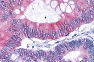 Immunohistochemistry-Paraffin: TNIK Antibody - BSA Free [NLS7401]