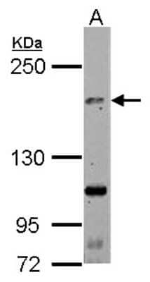 Western Blot: TNIK Antibody [NBP2-20674]