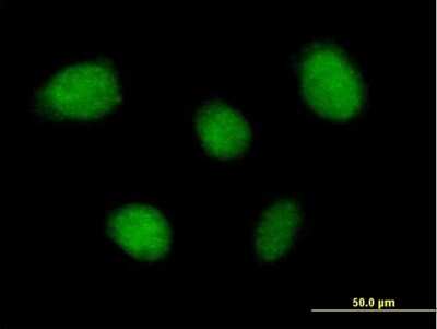 Immunocytochemistry/ Immunofluorescence: TNIP1 Antibody [H00010318-B01P]
