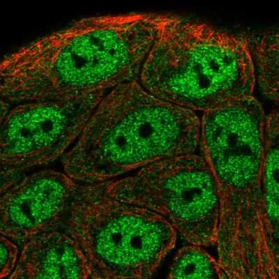 Immunocytochemistry/ Immunofluorescence: TNIP1 Antibody [NBP2-57965]