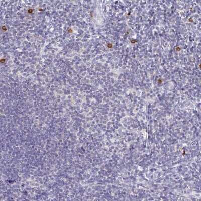 Immunohistochemistry: TNIP1 Antibody [NBP2-32705]