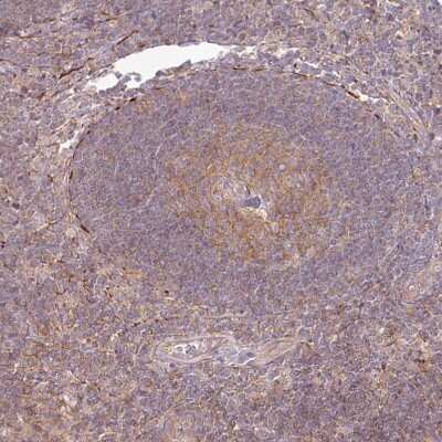 Immunohistochemistry-Paraffin: TNIP1 Antibody [NBP1-89306]